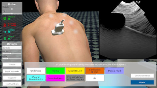 超声波成像模拟病人 - LUS - Medical Simulation Technologies - 用于护士护理 / 用于急救护理 / 重症监护