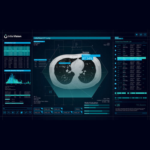 分析软件 - Beijing Infervision Technology Co. Ltd. - 报告 / 加工 / 确认