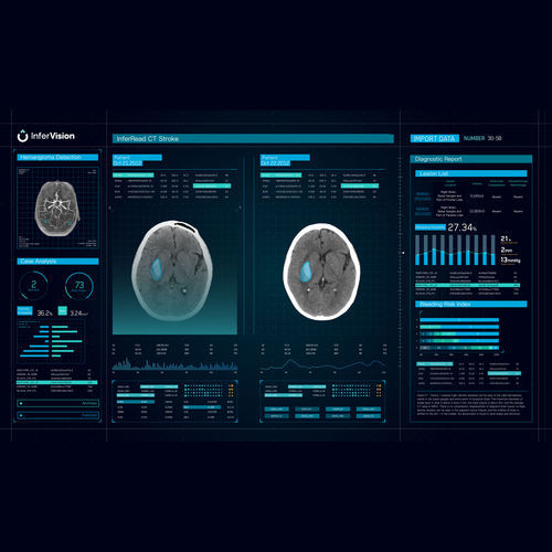 警报管理软件 - CT Stroke - Beijing Infervision Technology Co. Ltd. - 加工 / 用于识别变异体 / 医用