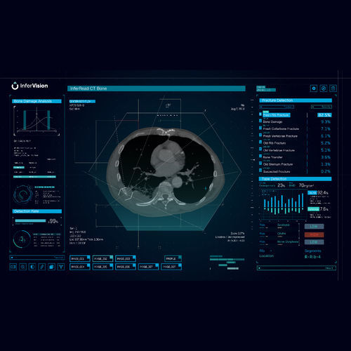 分析软件 - Bone - Beijing Infervision Technology Co. Ltd. - 图像分析 / 筛查 / 医用