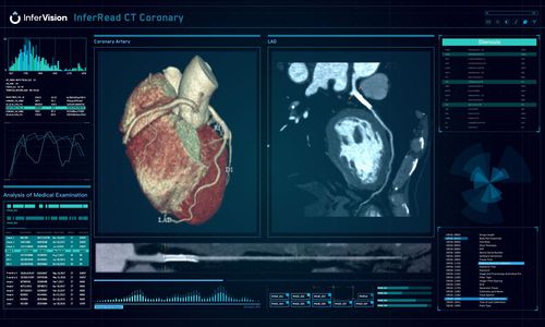 医用软件 - InferRead® - Beijing Infervision Technology Co. Ltd. - CT计算机断层扫描 / 分析 / 数据管理
