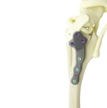 腿部兽用压迫骨板 - TPLO - Anhui Bailu Small Animal Orthopedic Instrument