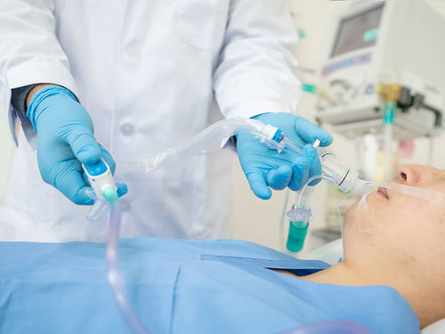 气管内插管吸气系统 - H206400 - Ningbo Xinwell Medical Technology - 用于气管切开术
