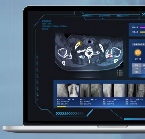云计算系统PACS系统 - NovaCloud® - Huiying Medical Technology (Beijing) Co., Ltd. - 医用