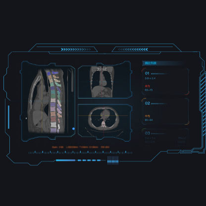 可视化Web应用程序 - Dr. Turing® - Huiying Medical Technology (Beijing) Co., Ltd. - 分析 / 医用 / CT计算机断层扫描