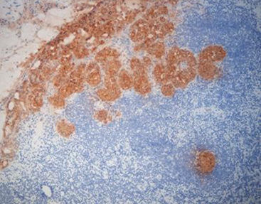 抗体试剂 - FCM0170 - Celnovte Biotechnology Co., Ltd. - 用于癌症 / 鼠源