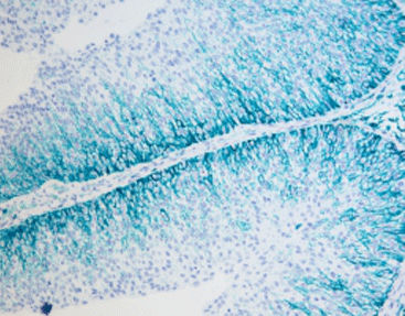 染色试剂套装 - SD8005 - Celnovte Biotechnology Co., Ltd. - 组织 / 用于免疫组织化学