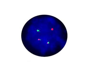 EML4-ALK融合基因快速诊断套装 - CF1012 - Celnovte Biotechnology Co., Ltd. - 伤寒 / 用于研究 / 肺癌