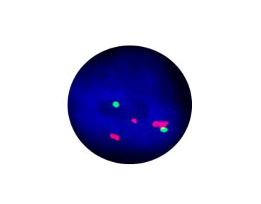 伤寒快速诊断套装 - CF1307 - Celnovte Biotechnology Co., Ltd. - 用于研究 / 用于癌症 / 基因
