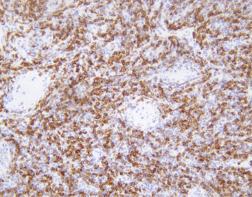 抗体试剂 - CBM-0042 - Celnovte Biotechnology Co., Ltd. - 细胞遗传学 / 细胞凋亡