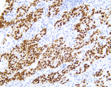 抗体试剂 - CSM-0131 - Celnovte Biotechnology Co., Ltd. - 临床 / 用于免疫组织化学 / 蛋白质