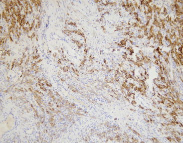 单克隆抗体试剂 - CIM-0151 - Celnovte Biotechnology Co., Ltd. - 多克隆抗体 / 用于研究 / 组织