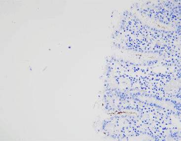 染色液试剂 - CHM-0173 - Celnovte Biotechnology Co., Ltd. - 抗体 / 染色 / 组织