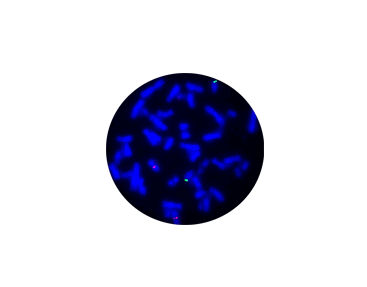 伤寒快速诊断套装 - CF1236 - Celnovte Biotechnology Co., Ltd. - 用于研究 / 用于癌症 / 医学研究