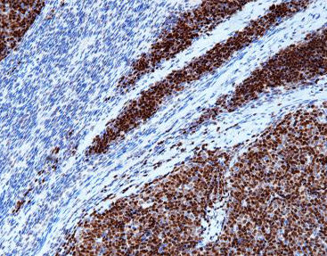 DNA聚合酶试剂 - CTM-0132 - Celnovte Biotechnology Co., Ltd. - 染色液 / 酶 / 染色