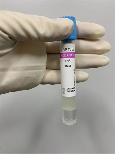 富血小板血浆采样管 - Cangzhou Yongkang Medical Devices Co., Ltd. - 圆柱 / 血液 / 等离子