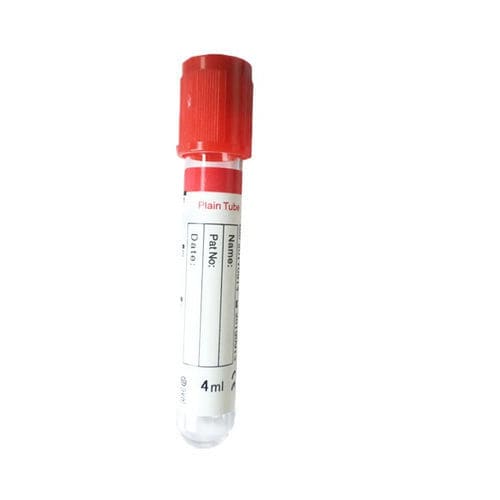 诊断采样管 - Cangzhou Yongkang Medical Devices Co., Ltd. - 免疫分析 / 圆柱 / 血液