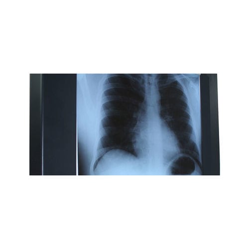 单联式X光片观片灯 - Woodmans Meditech - LED