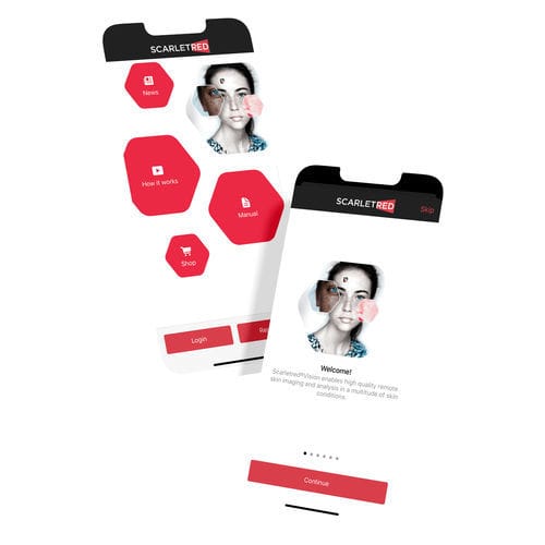 控制安卓应用程序 - Scarletred®Vision - SCARLETRED Holding GmbH - 捕获 / 校准 / 皮肤科