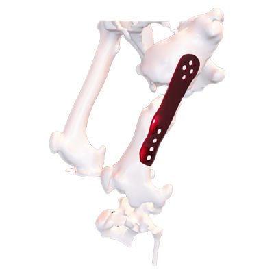 通用兽用压迫骨板 - Osteophoenix