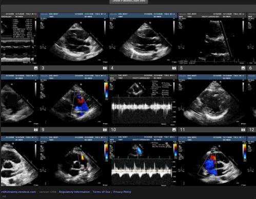 医学成像PACS系统 - Cardiology - UltraLinq
