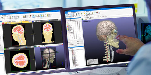 医学影像软件 - Simpleware ScanIP - Synopsys Simpleware Product Group - 医用 / 用于研究 / 图像分析