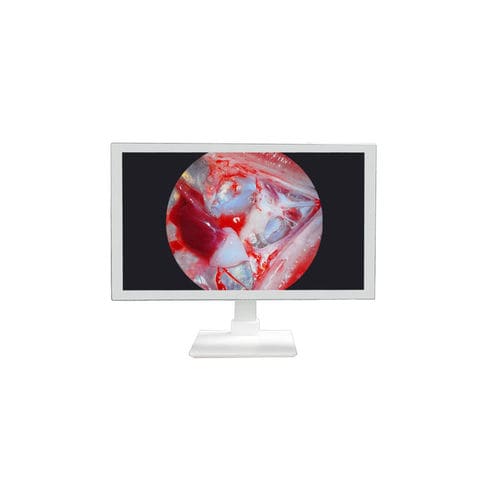 医用显示器 - TU-24M1080P - Shenzhen Tuyou Medical Imaging Co., Ltd.​ - 手术室 / 手术 / 27"