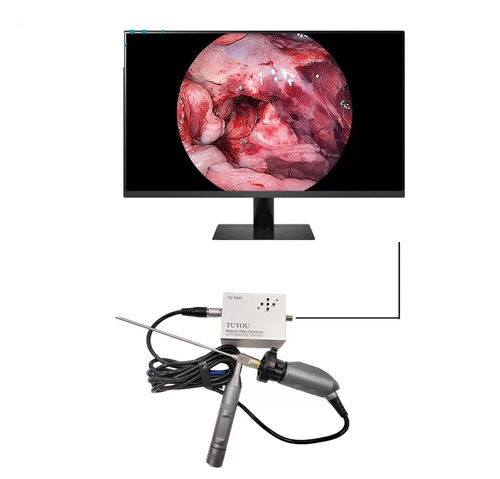 内窥镜摄像机 - TU-Y2HC - Shenzhen Tuyou Medical Imaging Co., Ltd.​ - 医用 / 数字 / 全高清