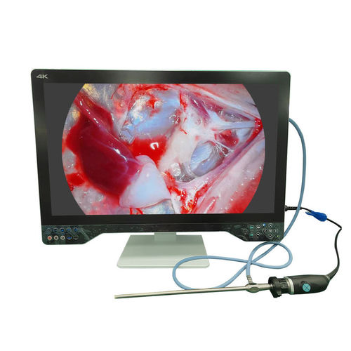 内窥镜摄像机 - TU-32LSD1A - Shenzhen Tuyou Medical Imaging Co., Ltd.​ - 医用 / 手术 / 数字