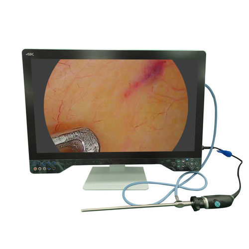 医用摄像机 - TU-32LSD1A - Shenzhen Tuyou Medical Imaging Co., Ltd.​ - 手术 / 数字 / 高解析度