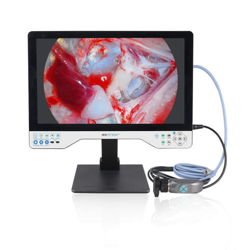内窥镜摄像机 - TU-24LSD101B - Shenzhen Tuyou Medical Imaging Co., Ltd.​ - 医用 / 数字 / VGA