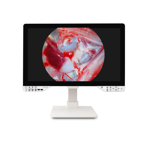 内窥镜摄像机 - TU-27LSD2B - Shenzhen Tuyou Medical Imaging Co., Ltd.​ - 数字 / VGA / 高解析度