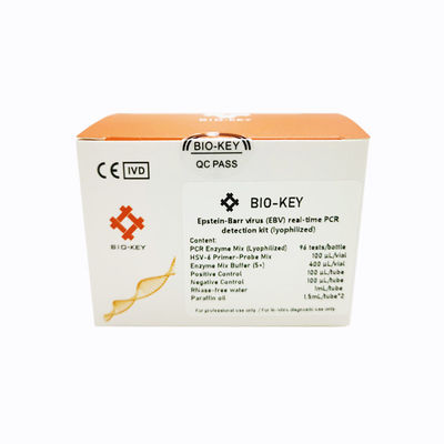传染病快速诊断套装 - BIK-QL-H0017 - Biokey Health - 埃-巴二氏病毒 / 血清 / 等离子
