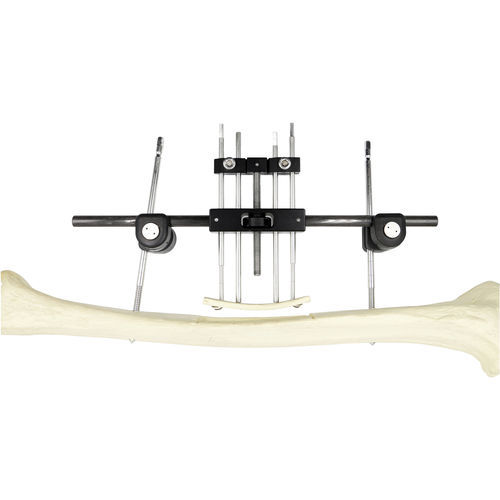 股骨外固定架 - Chongqing FWS Medical Device - 管状