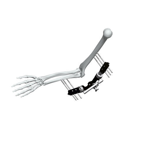 肘外固定架 - FE5M-D040 - Chongqing FWS Medical Device - 管状
