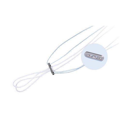 肩锁韧带重造缝合纽 - Chongqing FWS Medical Device