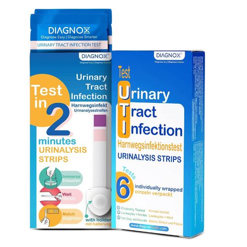尿路感染试剂带 - Urinox  - Diagnox Health - 尿液分析 / 亚硝酸盐 / 白细胞尿