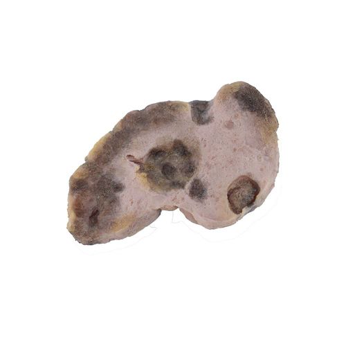 卵巢解剖模型 - PS-003 - MeiWo Science - 教学 / 用于癌症 / 硅胶