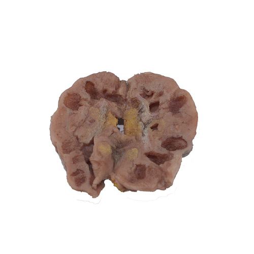 肾脏解剖模型 - PM-001 - MeiWo Science - 健康教育 / 教学 / 用于癌症