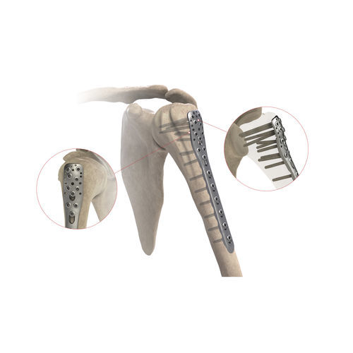 肱骨加压接骨板 - AS.SH.026 - Ases Orthopedics - 近端 / 侧面 / 锁定