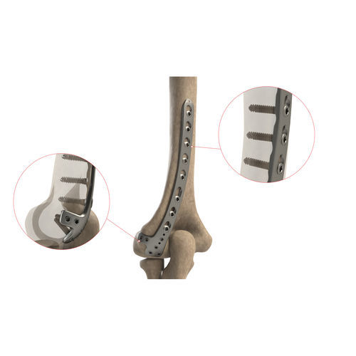 肱骨加压接骨板 - AS.E.022 - Ases Orthopedics - 远侧 / 后外侧 / 锁定