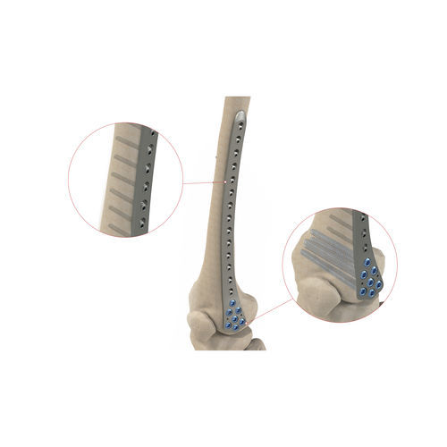股骨髁加压接骨板 - Ases Orthopedics - 远侧 / 锁定