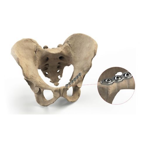 骨盆加压接骨板 - Ases Orthopedics - 锁定