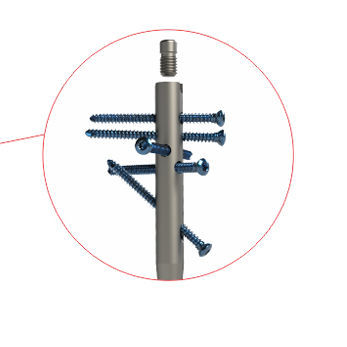 肱骨髓内钉 - 4T1-4021000 - Ases Orthopedics