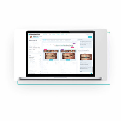 牙科人工智能平台 - Dental Monitoring - 图像分析 / 加工 / 捕获