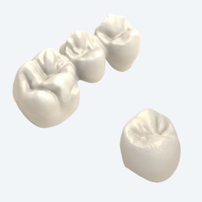 亚克力假牙 - NEW ANCORVIS S.r.l - 复合材料 / 氧化锆 / 钴铬合金