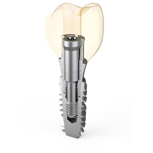 钛种植体基台 - Master Fix - ARUM DENTISTRY Co., Ltd. - 外部 / 角形 / 螺杆