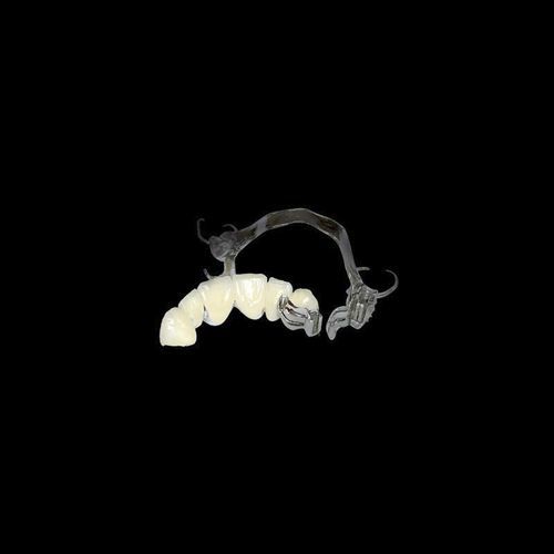 陶瓷牙桥 - Shenzhen Alcadent Co.Ltd Alcadent Dental Laboratory - 下切牙 / 可拆卸