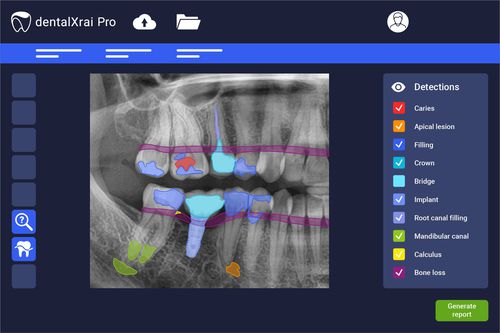 分析软件 - dentalXrai Pro 3.0 - dentalXrai GmbH - 评估 / 医用 / 牙科