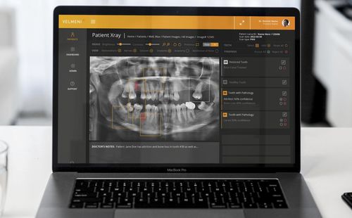 医学成像人工智能平台 - Second Dentist ™ - VELMENI - 医疗 / 牙科 / 分析
